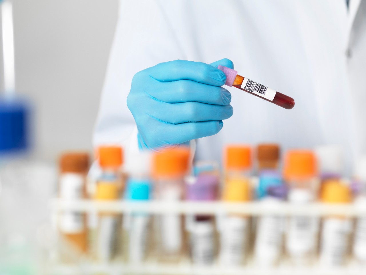 Laboratory technician preparing sample and wearing gloves